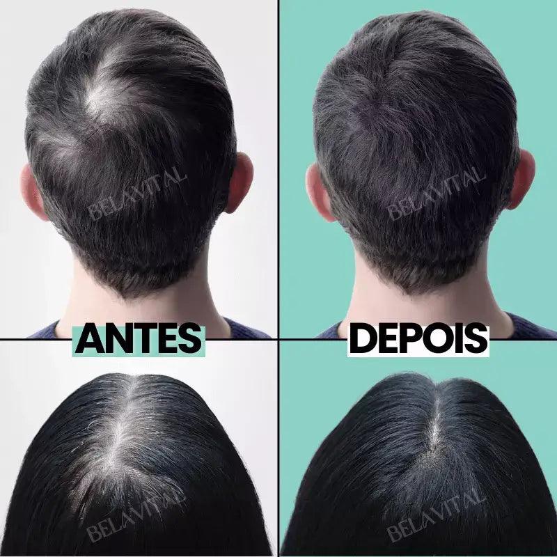 Imagem do produto 9